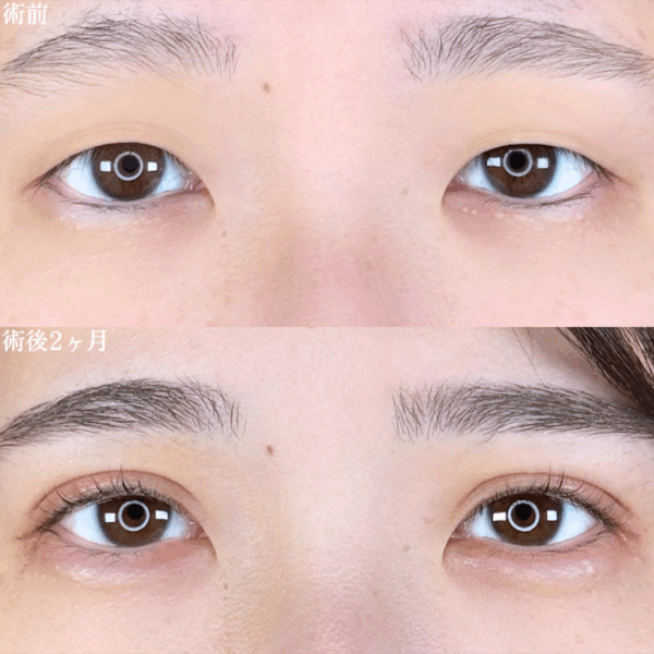 No.8917の症例写真